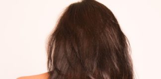 2 natural and home remedy tips to cure sunburn faster cure sunburn redness