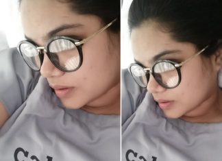 Home Clinic Calee Noida 324x235 - Home